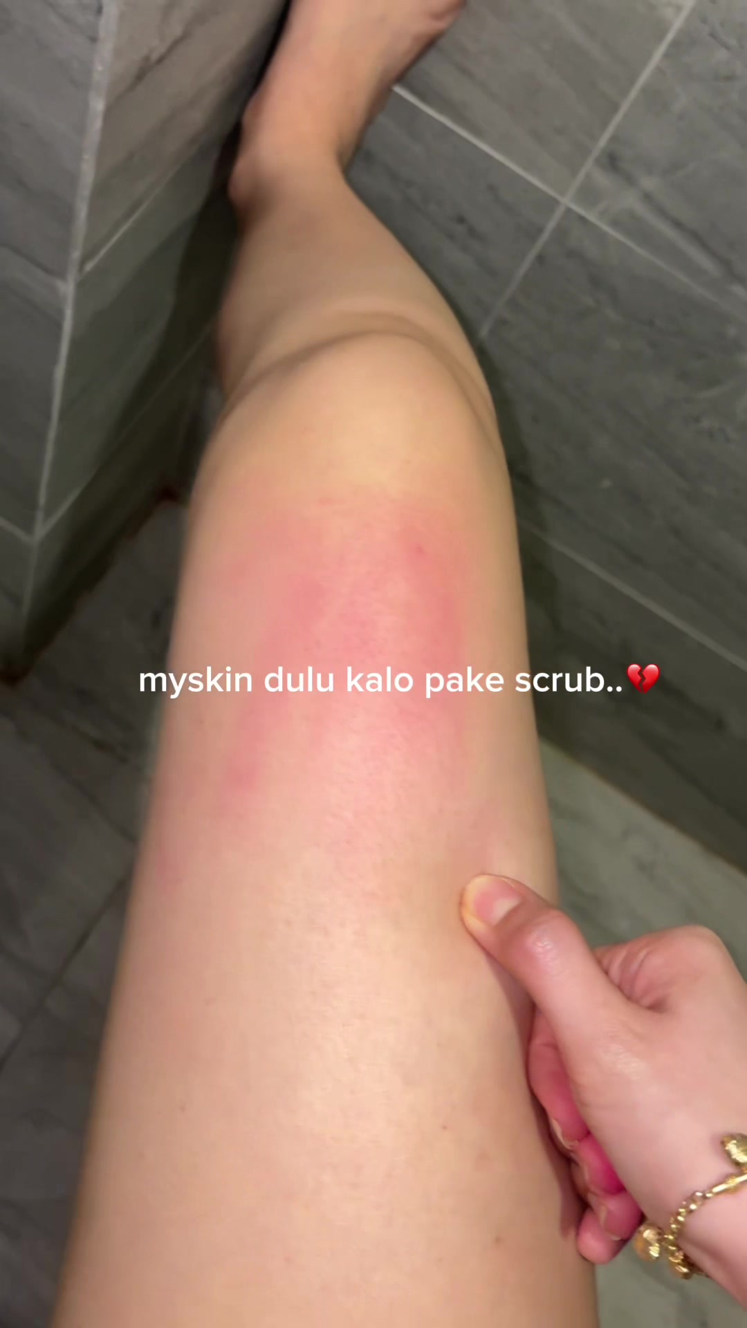@anggi ᥫ᭡