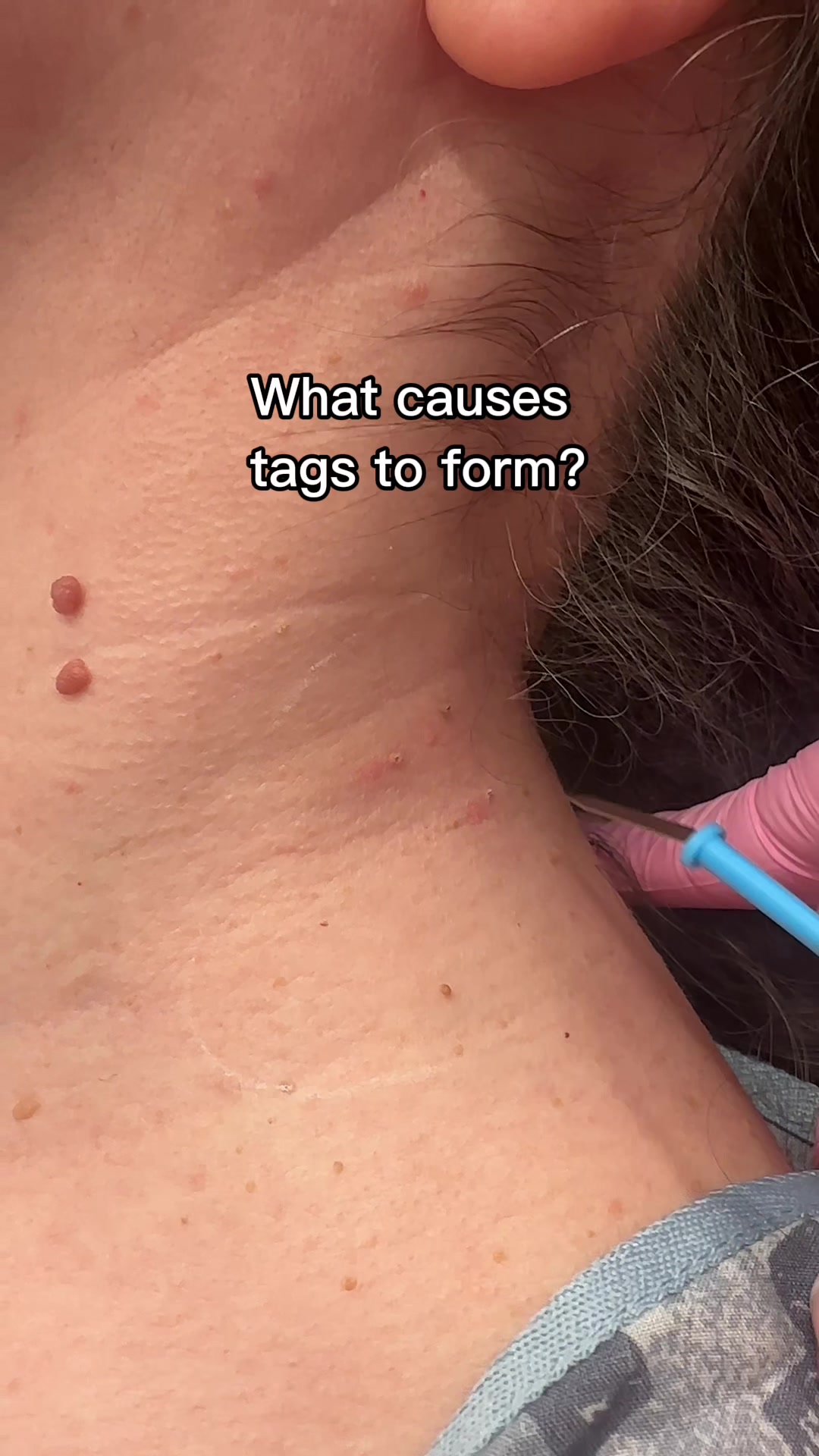 @Rosedermnyc