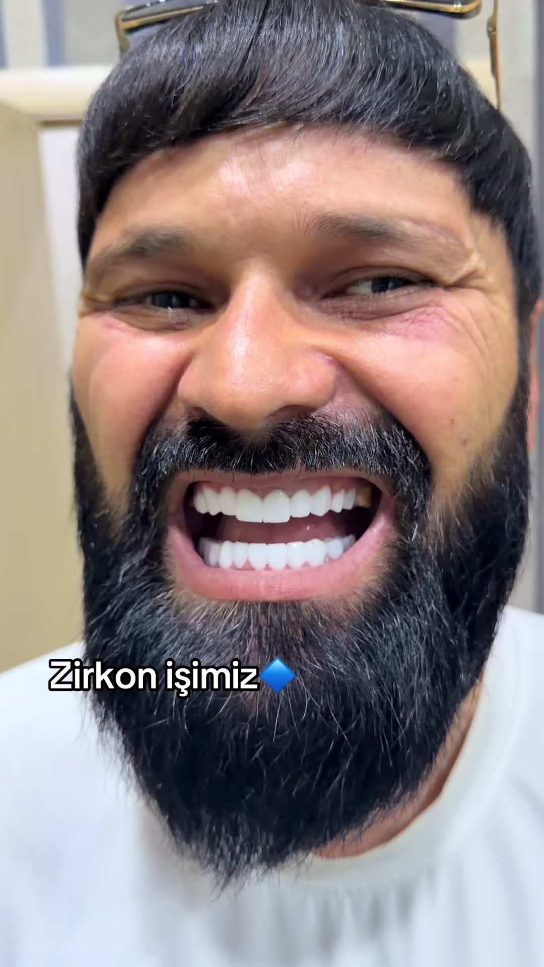@stomatoloq  diş həkimi