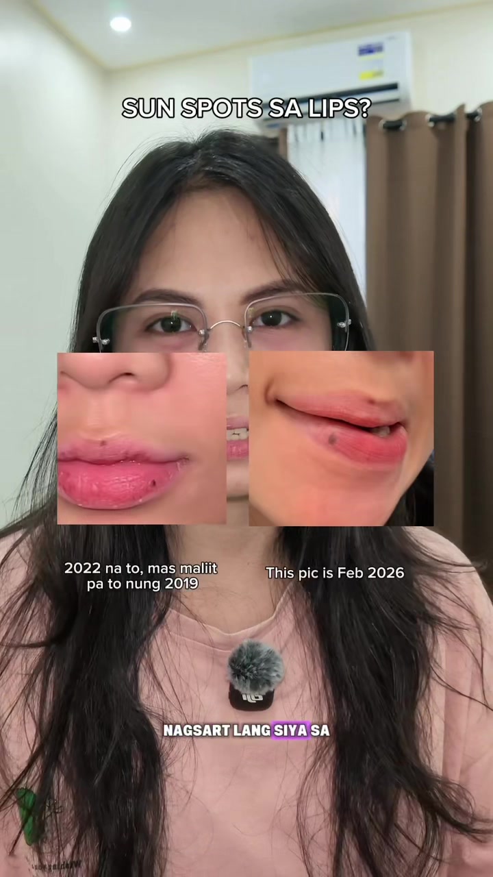 @Elay | The Skincare Junkie