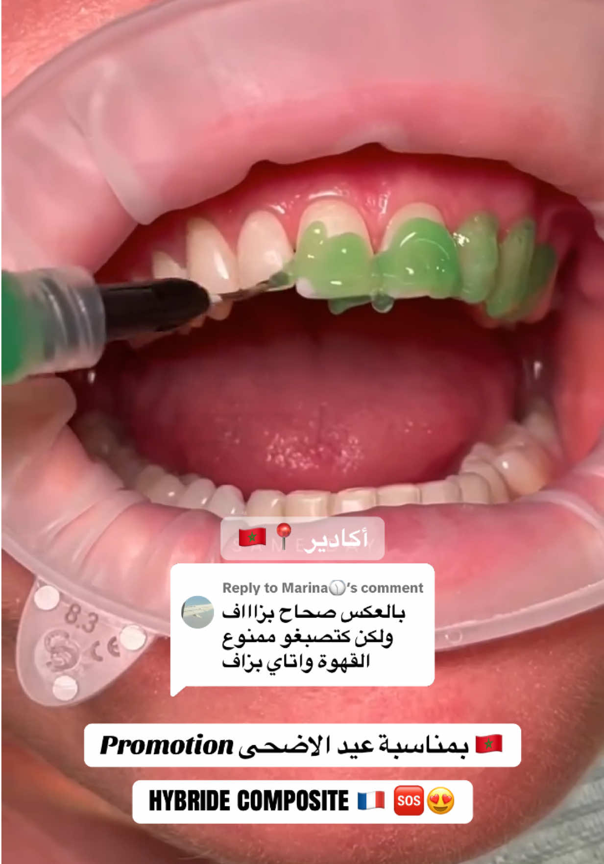 @brightsmileee1