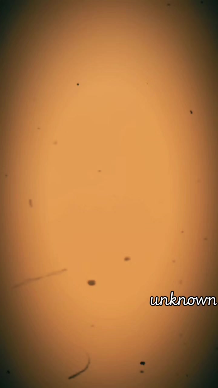 @unknown