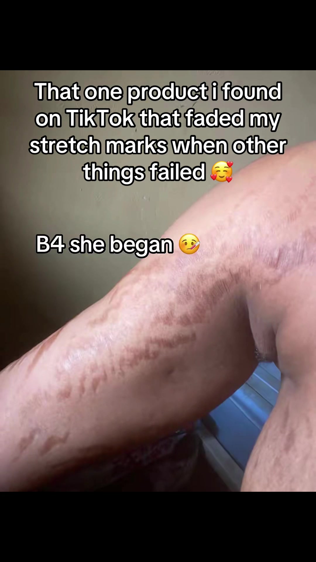 @Radiant skin