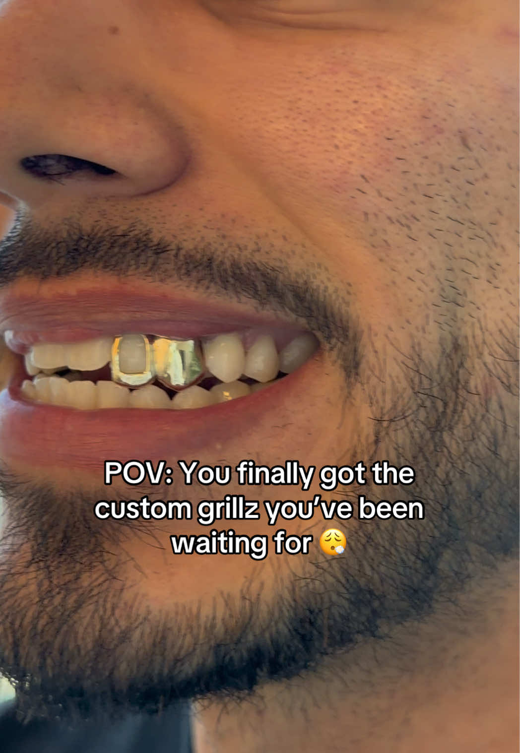 @AZ Grillz Plug