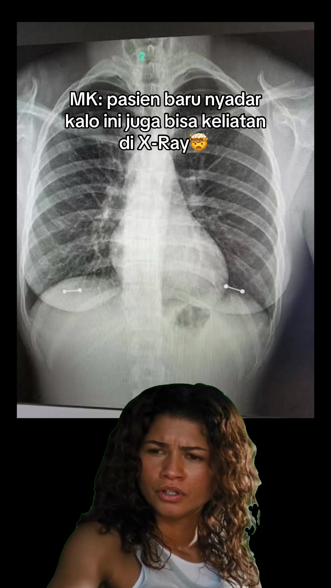 @Sobat Radiology