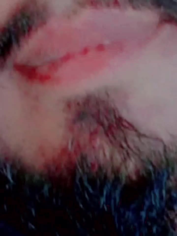 @hi