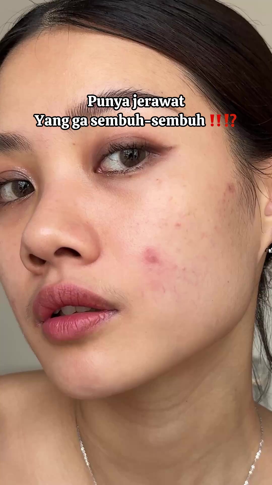 @Karen Kurniawan