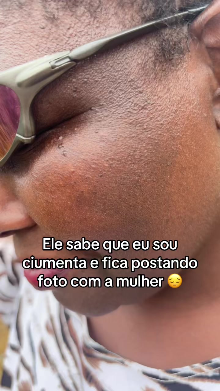 @Nilzeterisada