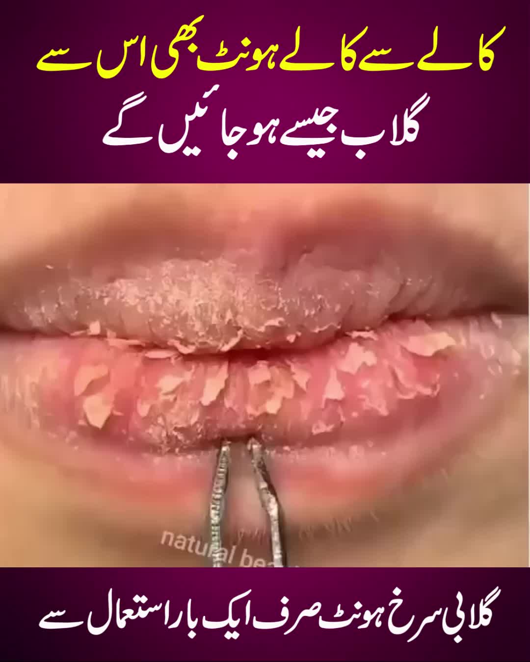 @Real Beauty