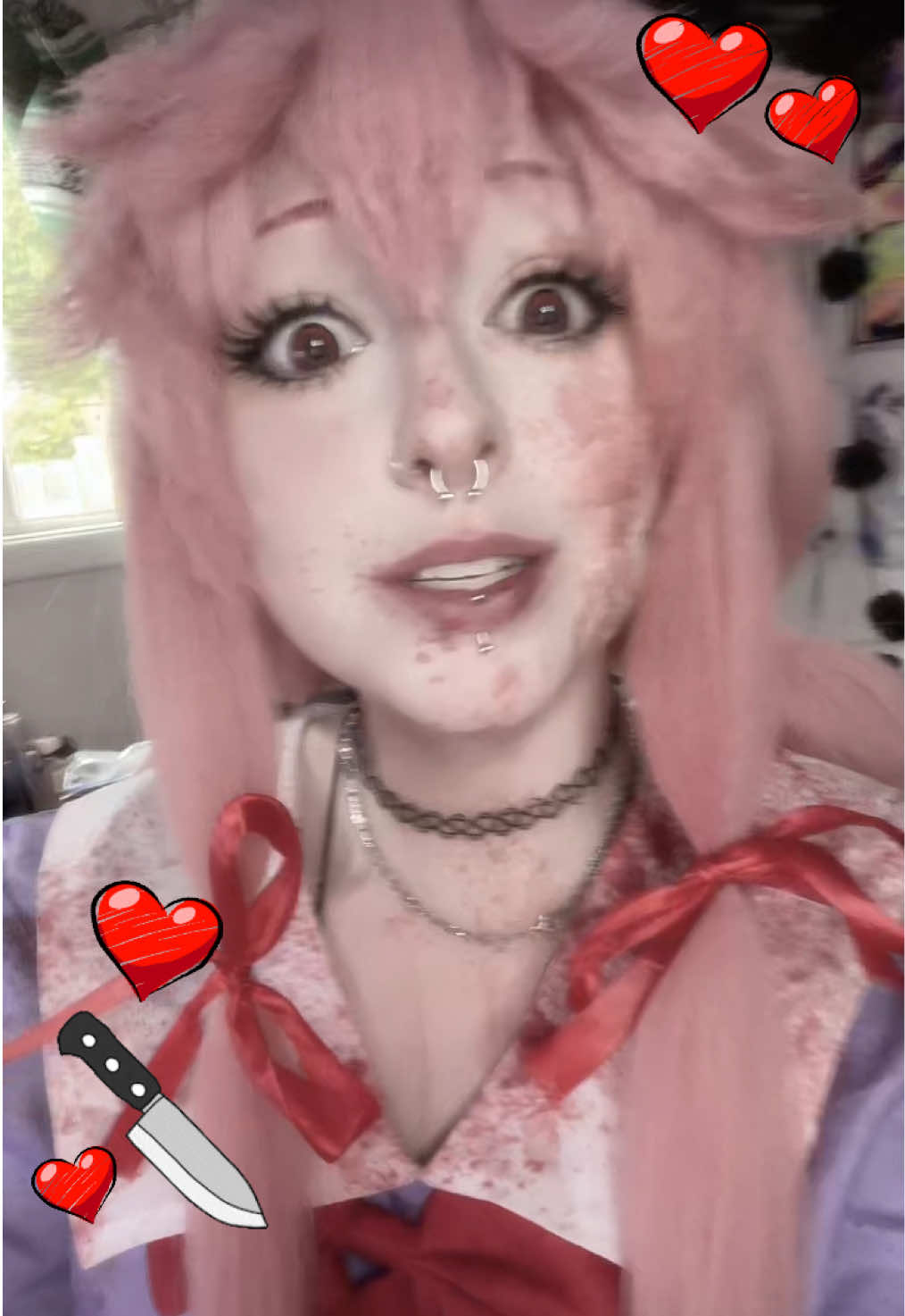 @Xoe