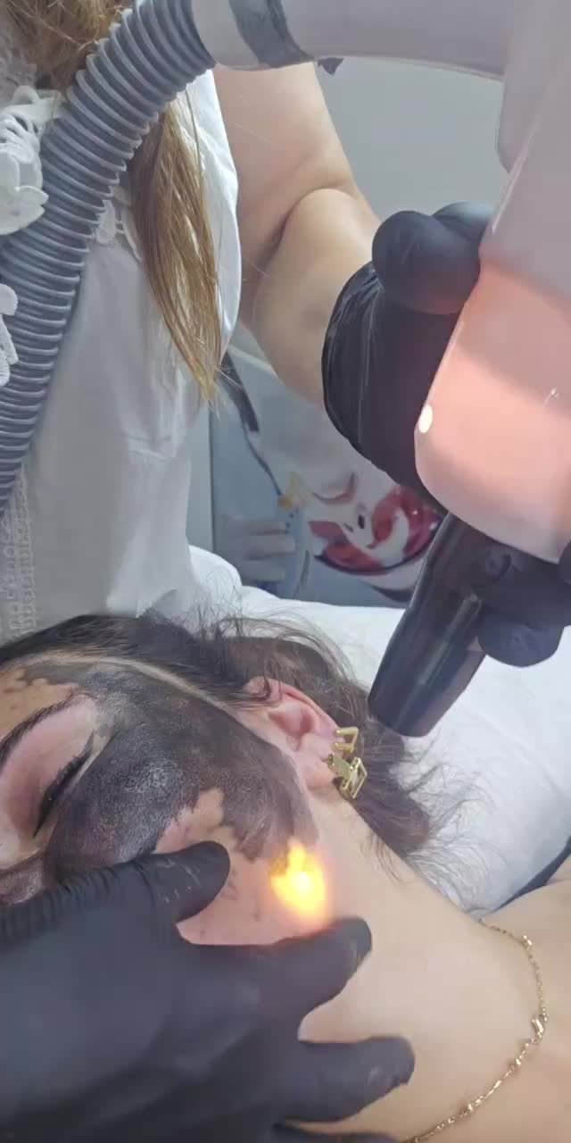 @ehmedli_kosmetoloq_lazeroloq