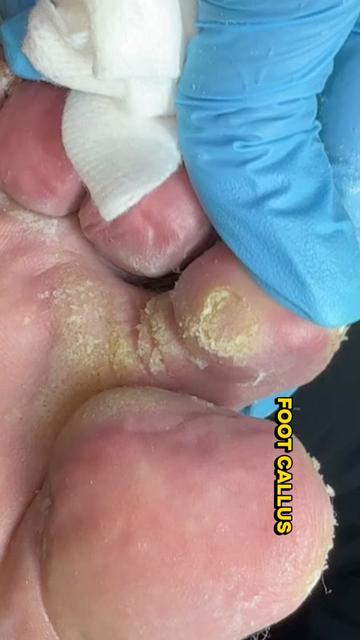 @Deniel Foot and Ankle Center