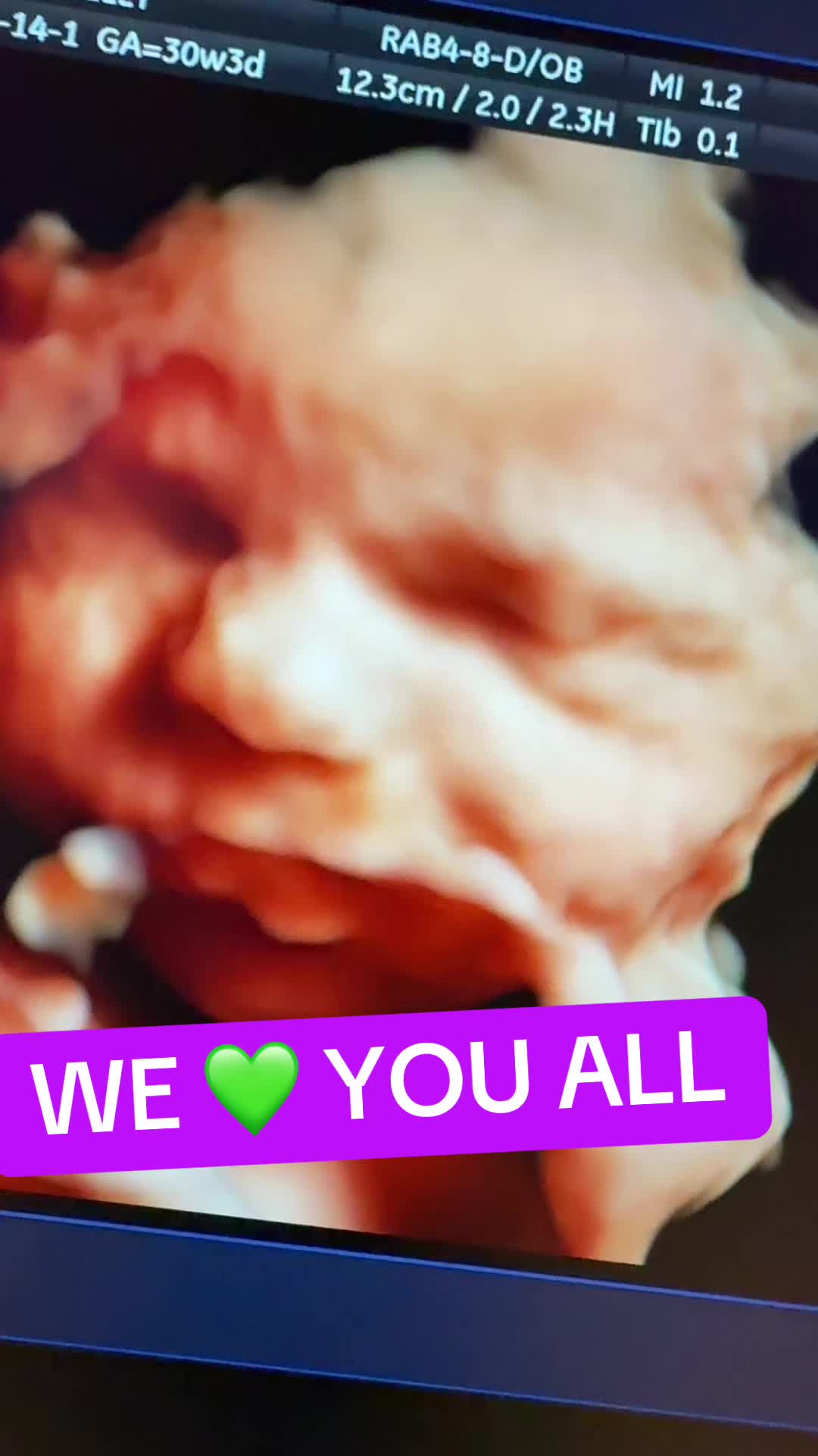 @PregnantSee Inc.