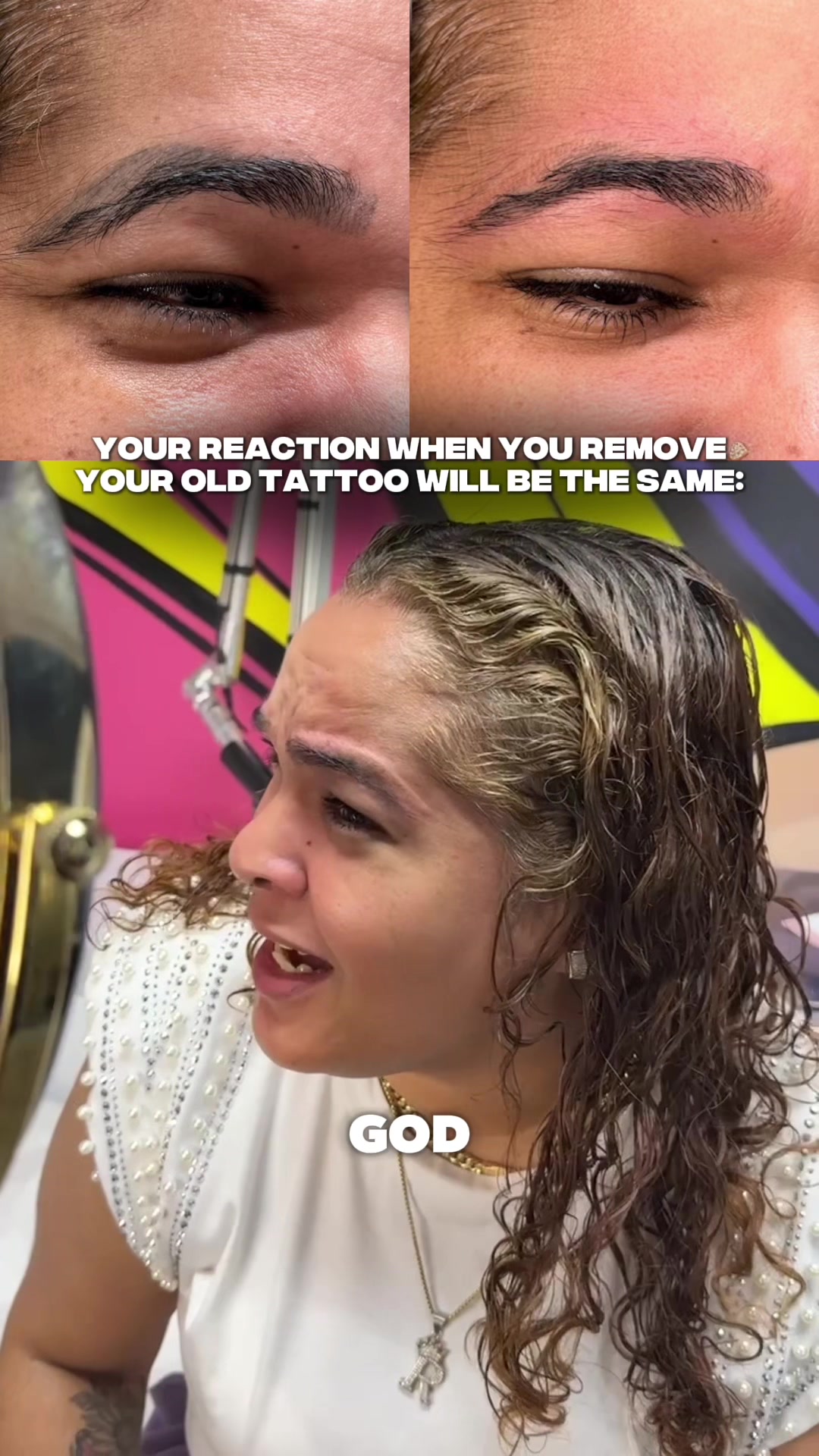 @Safe Eyebrows Tattoo Removal🗽