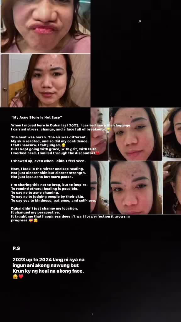 @Māry🎗️