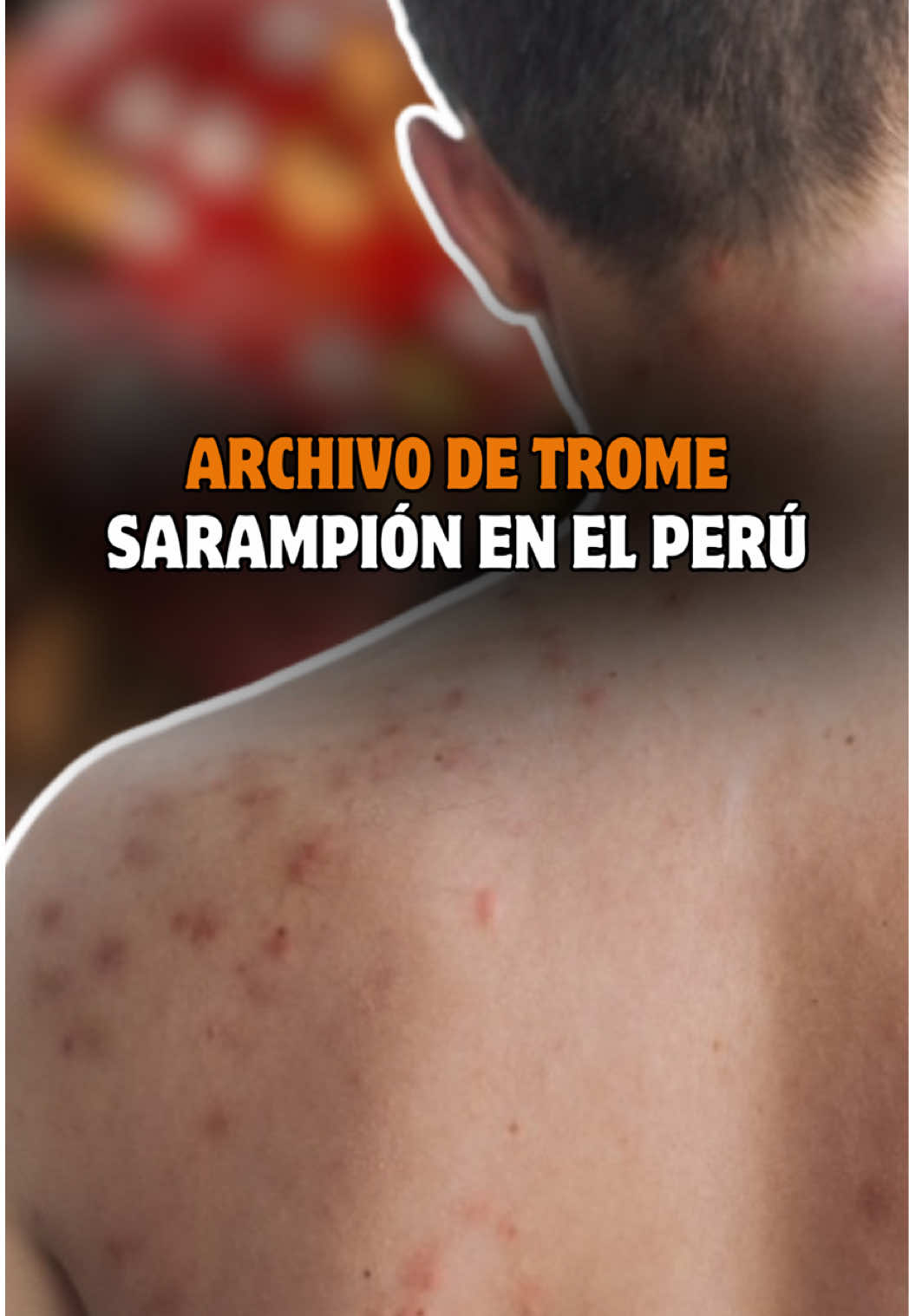 @Trome oficial