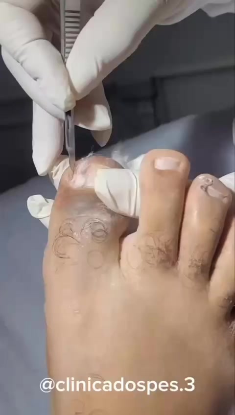 @Cl&iacute;nica dos p&eacute;s 👣
