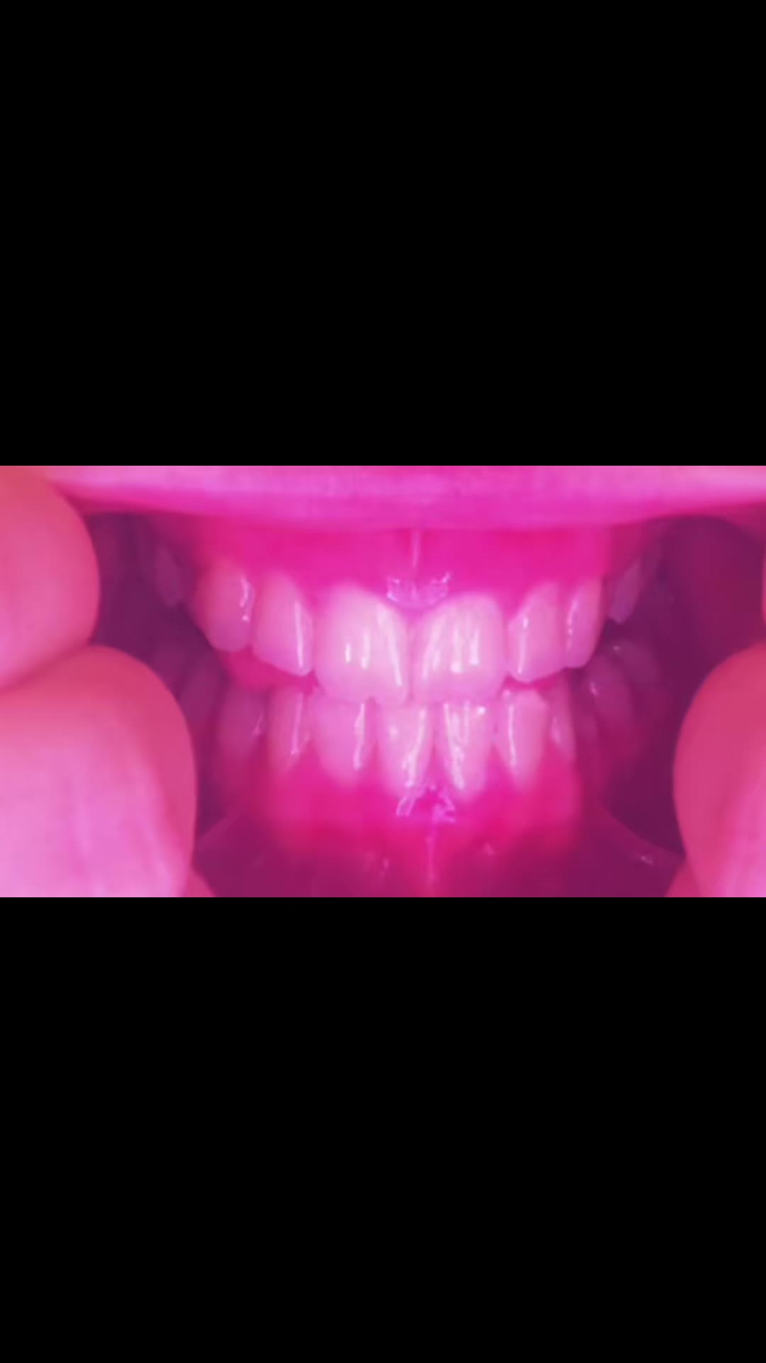 @teeetharecool