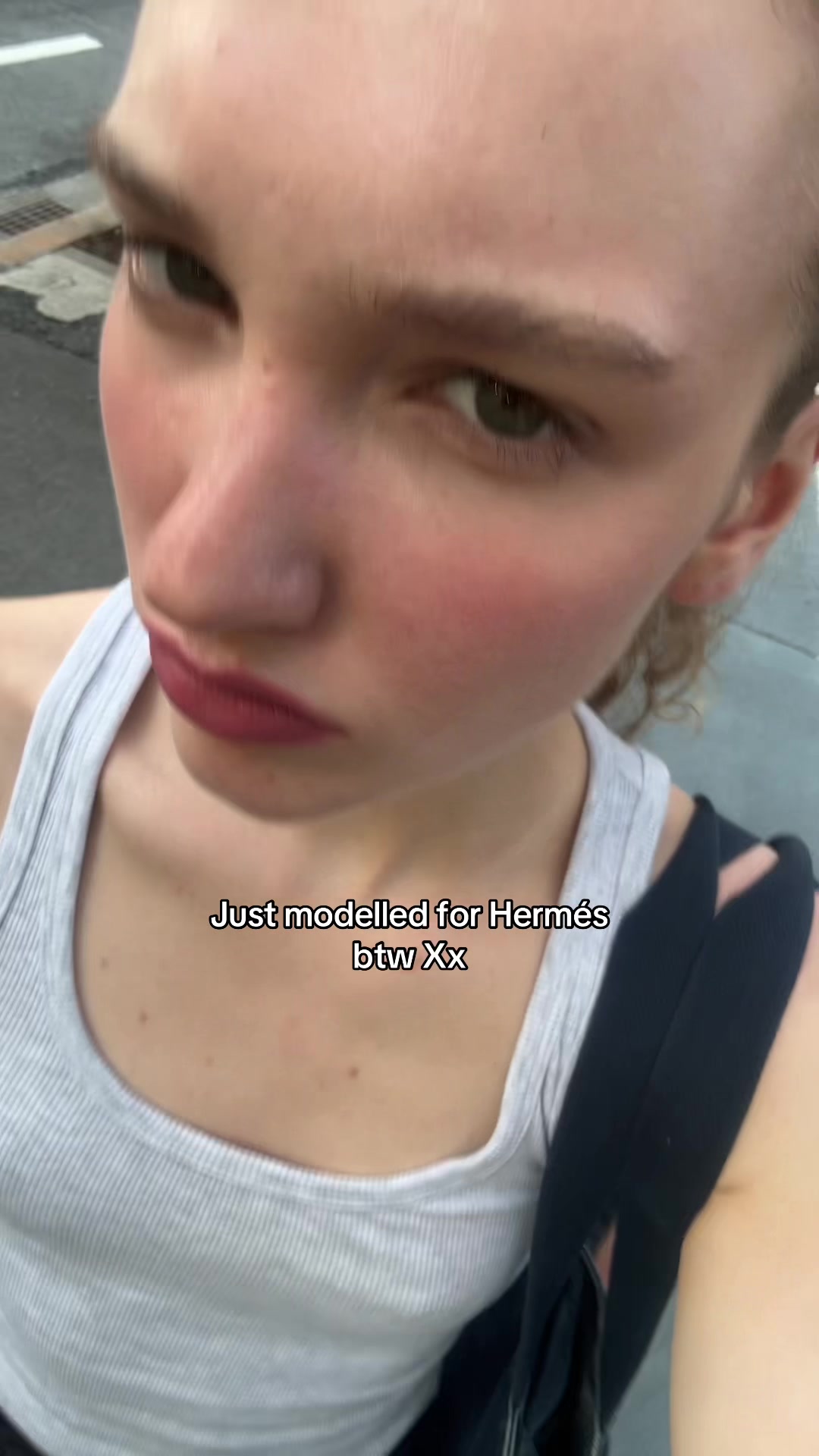 @Anne