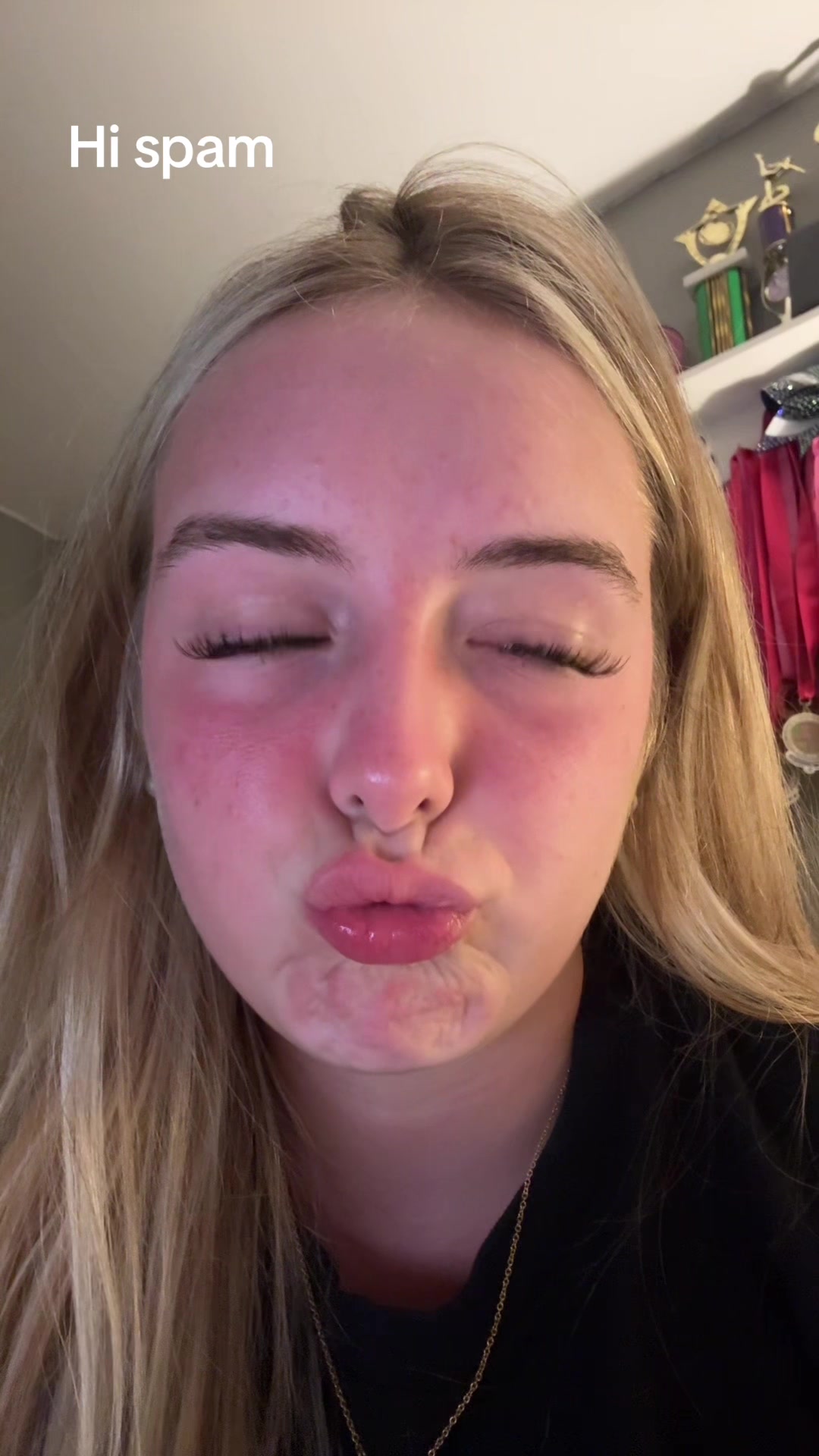 @Ry ry