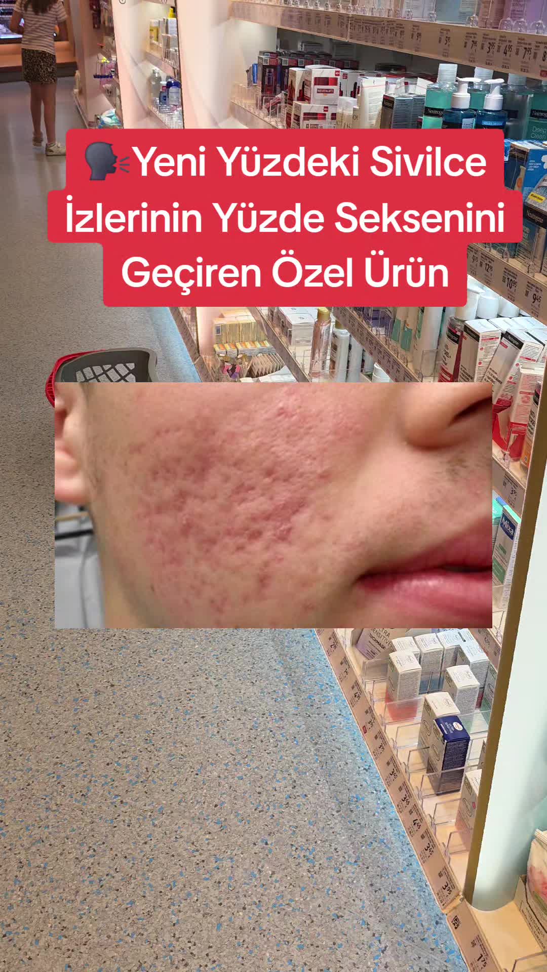@Gurbetana27