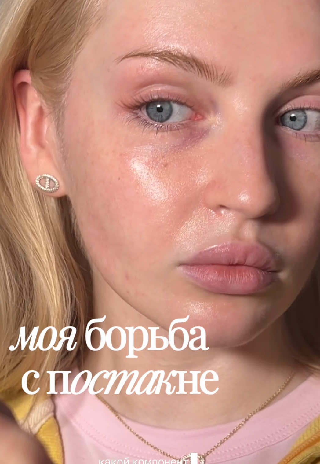 @Даная тгк ангел хлоя