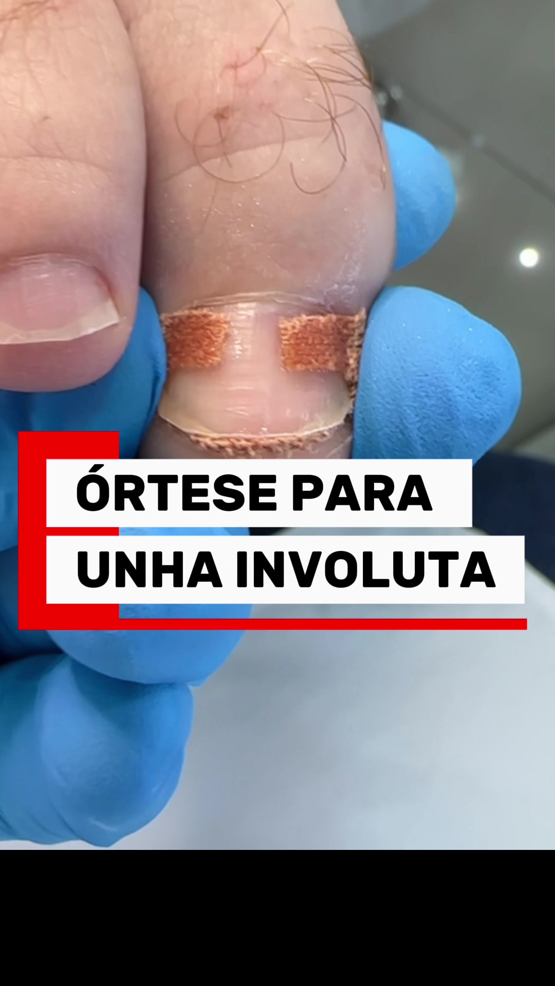 @Podocurebr