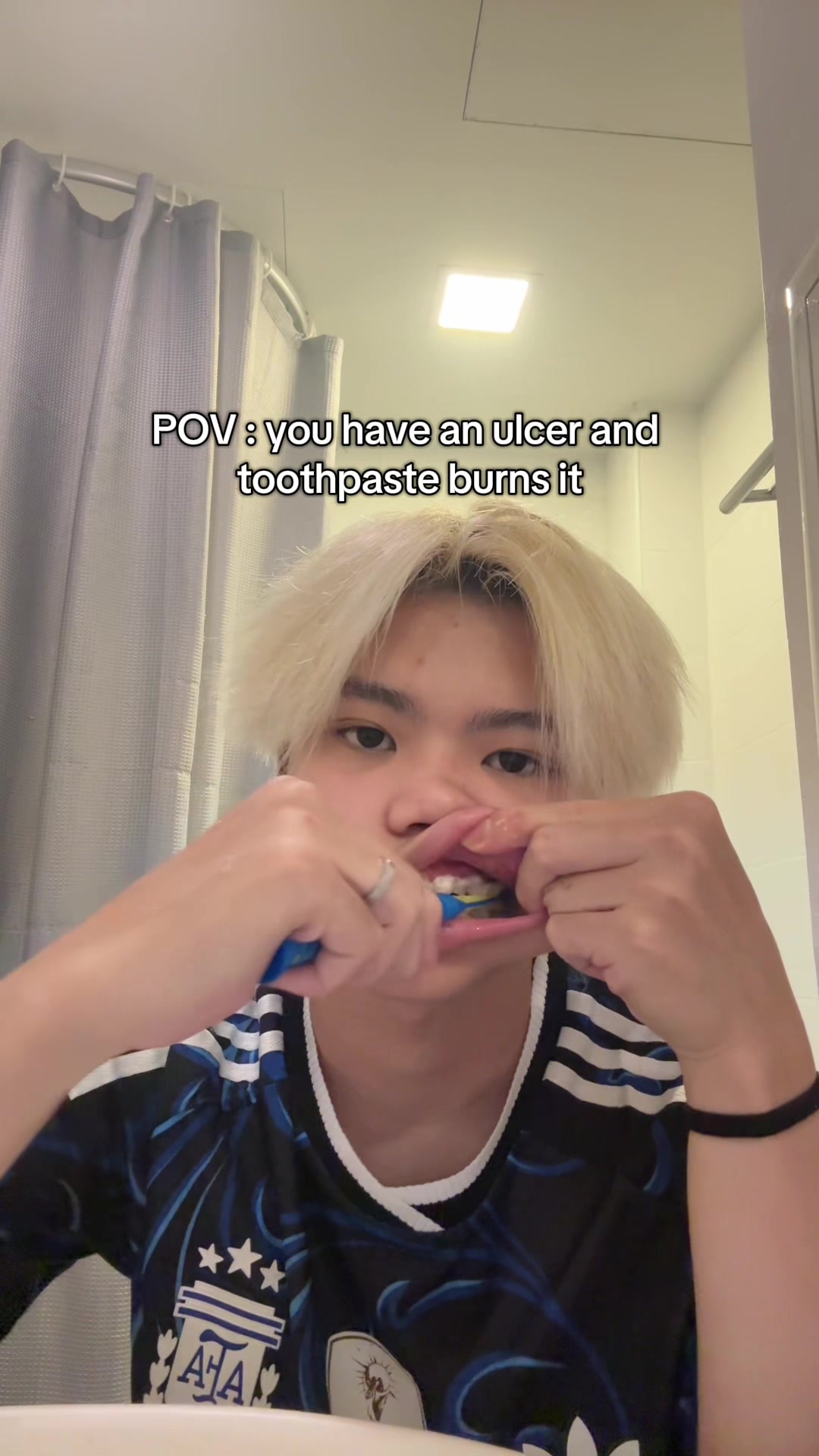 @ce