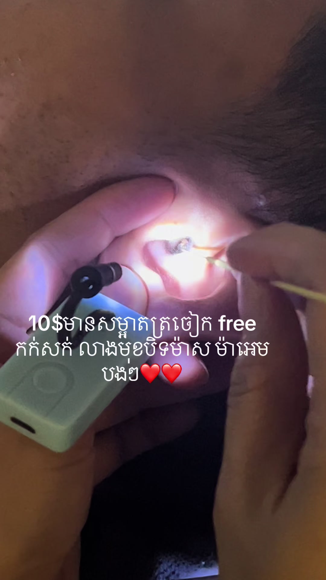 @ហាង សំអាតត្រចៀក 081 674455