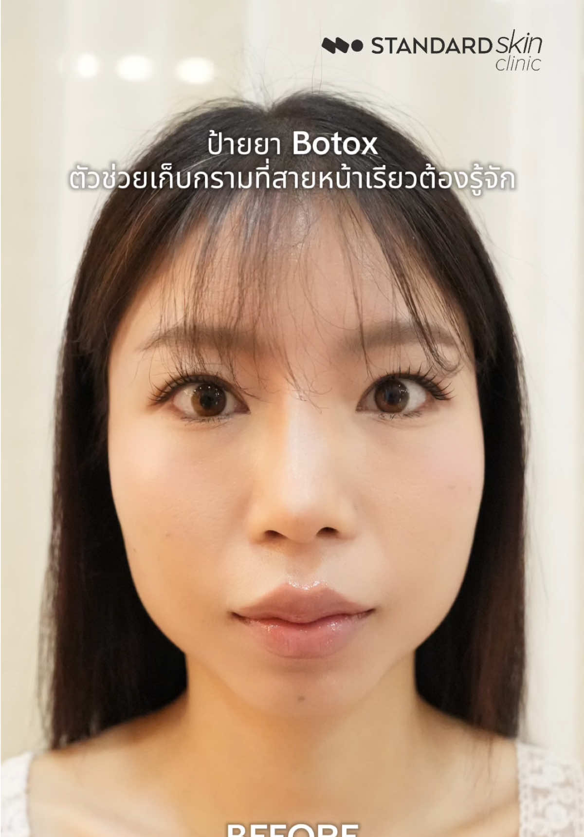 @Standard Skin clinic