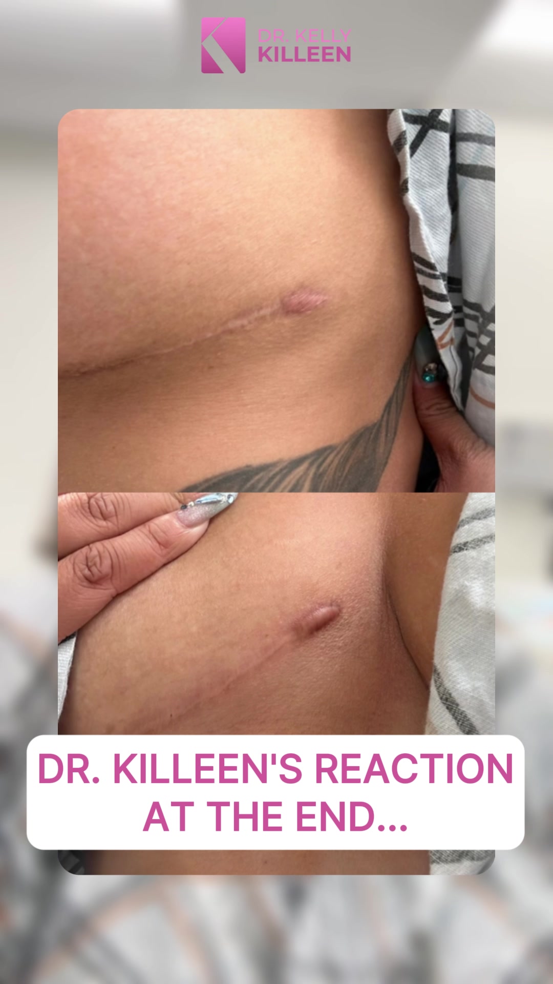 @Kelly Killeen, MD, FACS