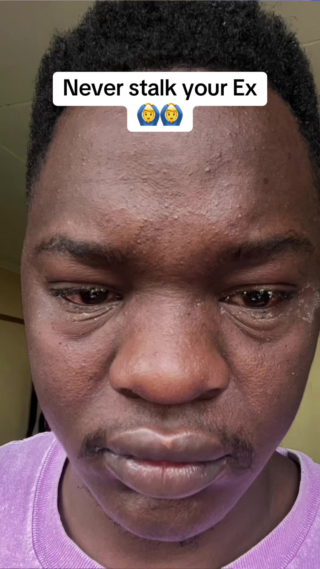 @Fedzack