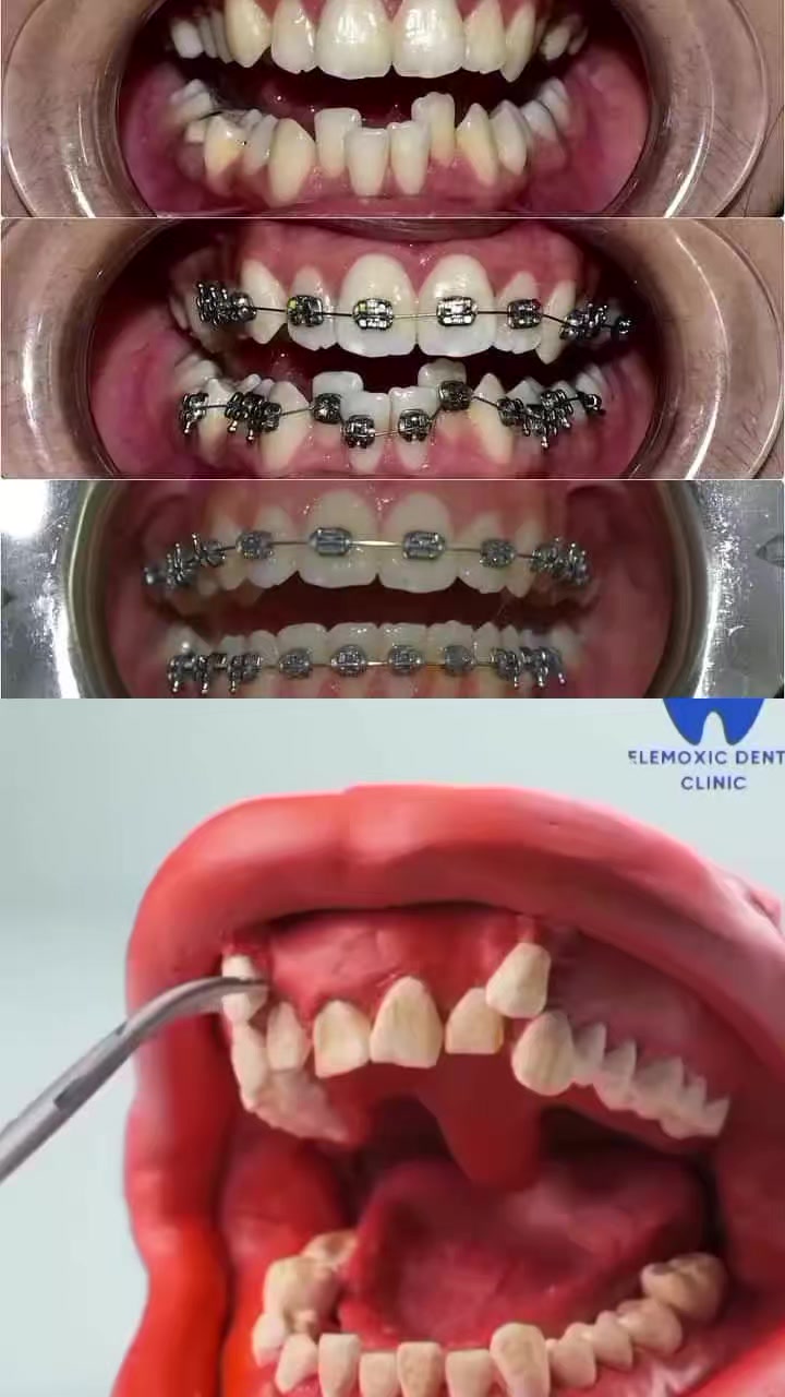 @celemoxic dental clinic