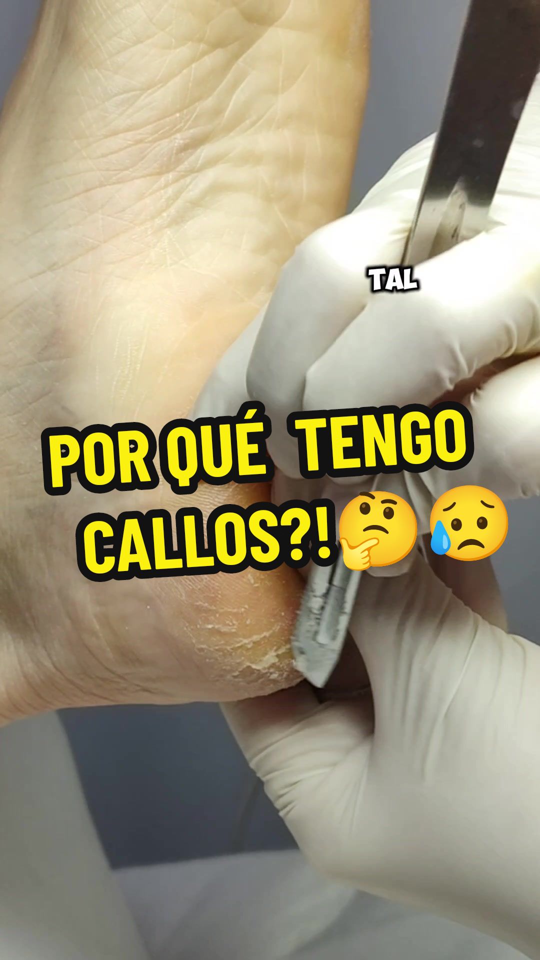 @podología calzada