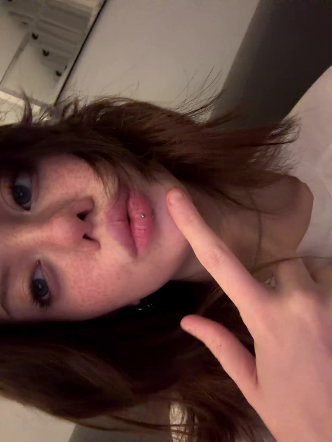 @глаукома