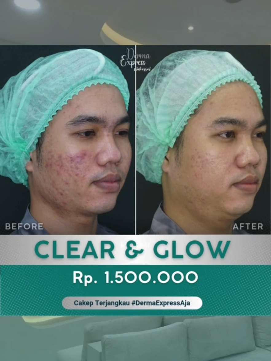 @dermaexpress_makassar