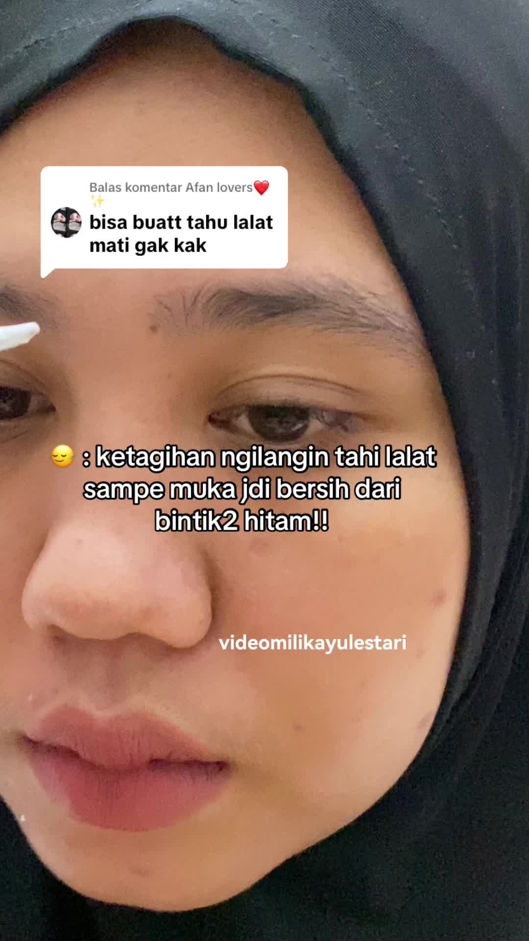 @Penghilangtahilalat.kaq.ay