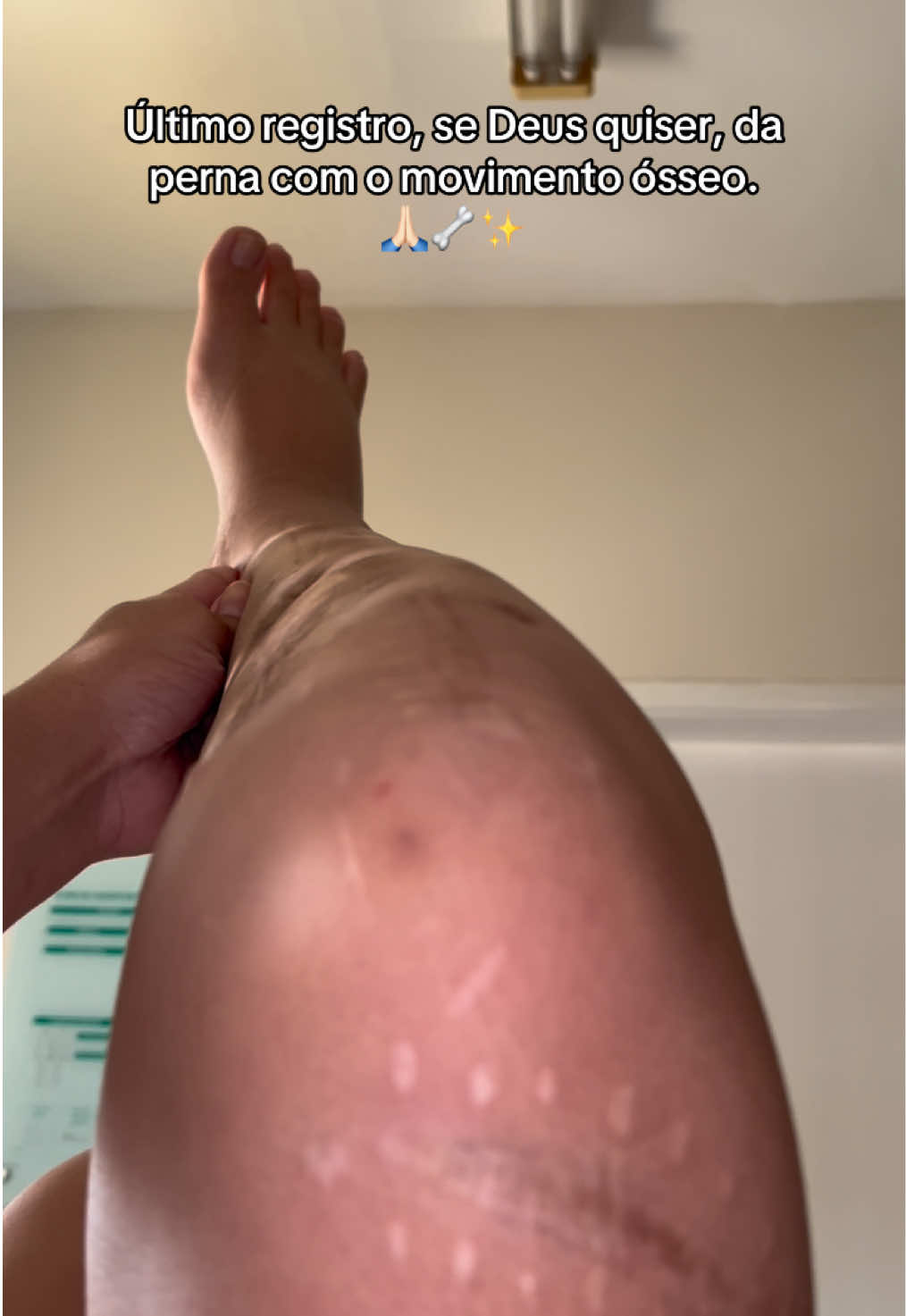 @Ana