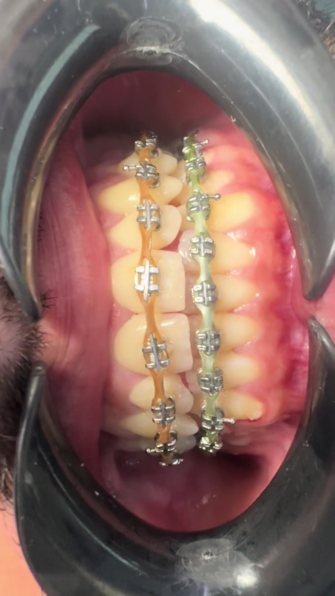 @Dr RahmatullahDental surgeon