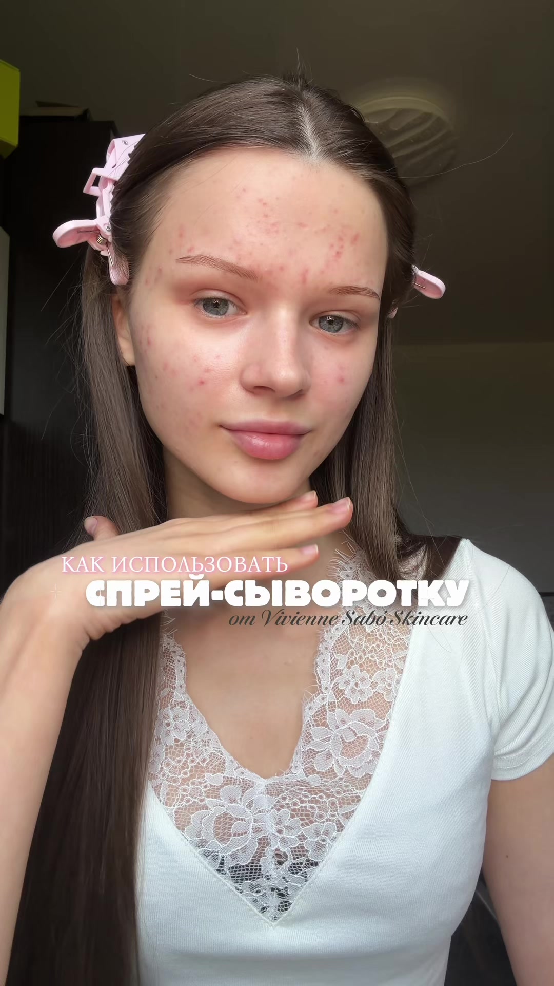 @кетикс