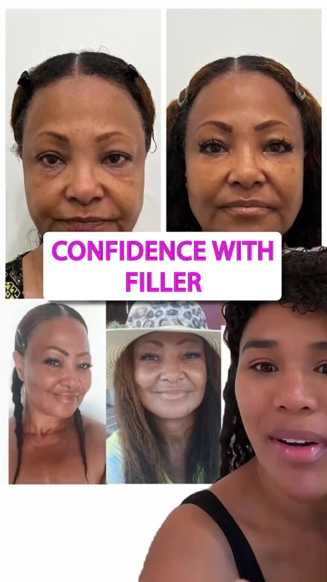 @Botox Filler Skin Los Angeles