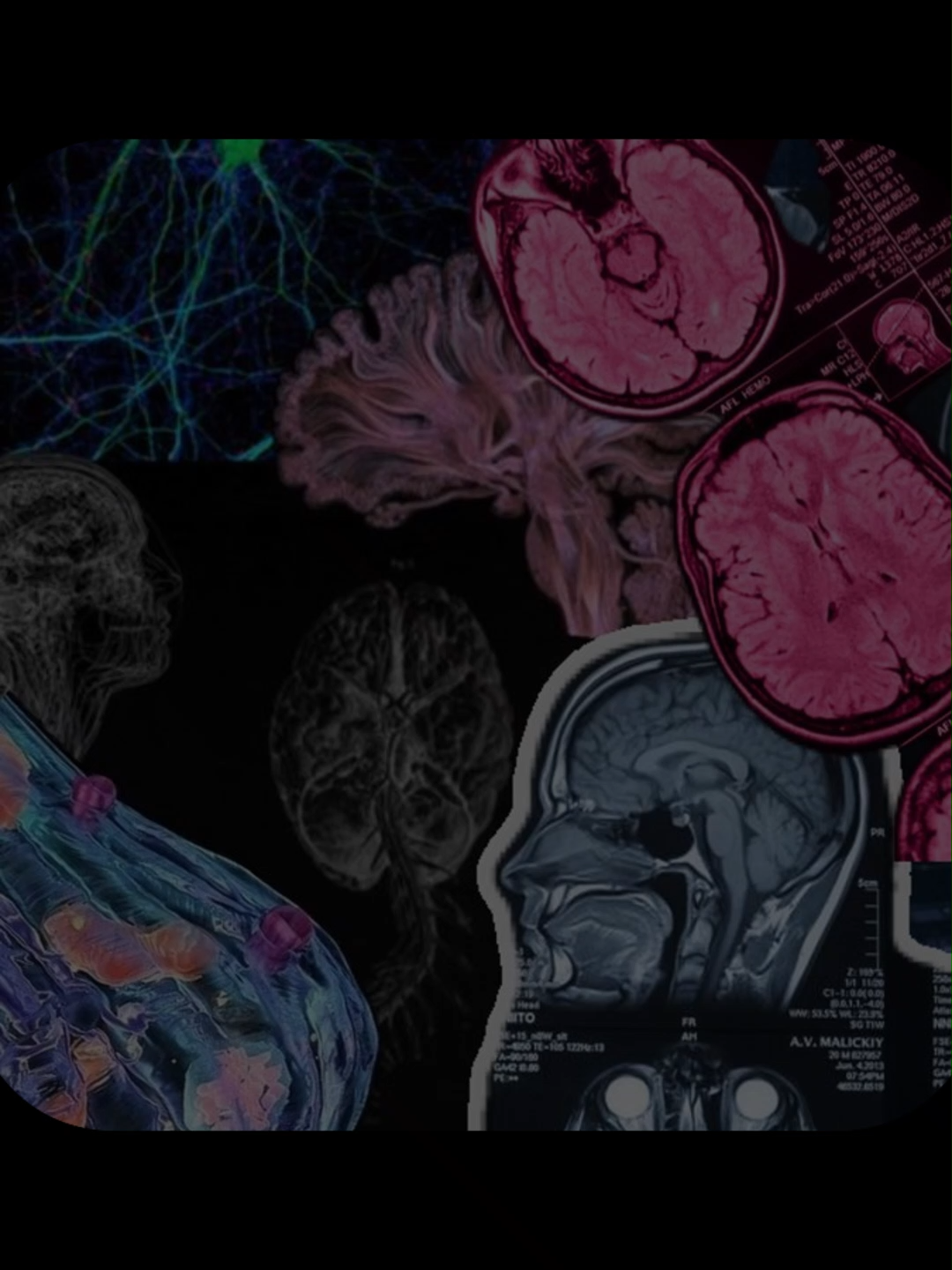 @NeuroWhisper