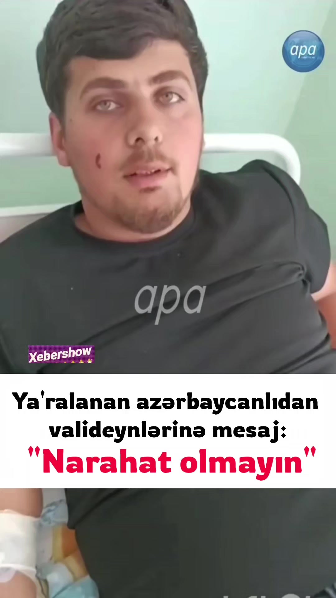 @Xebershow