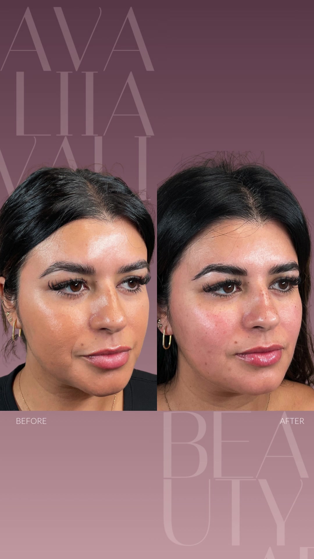 @Avalii Aesthetics