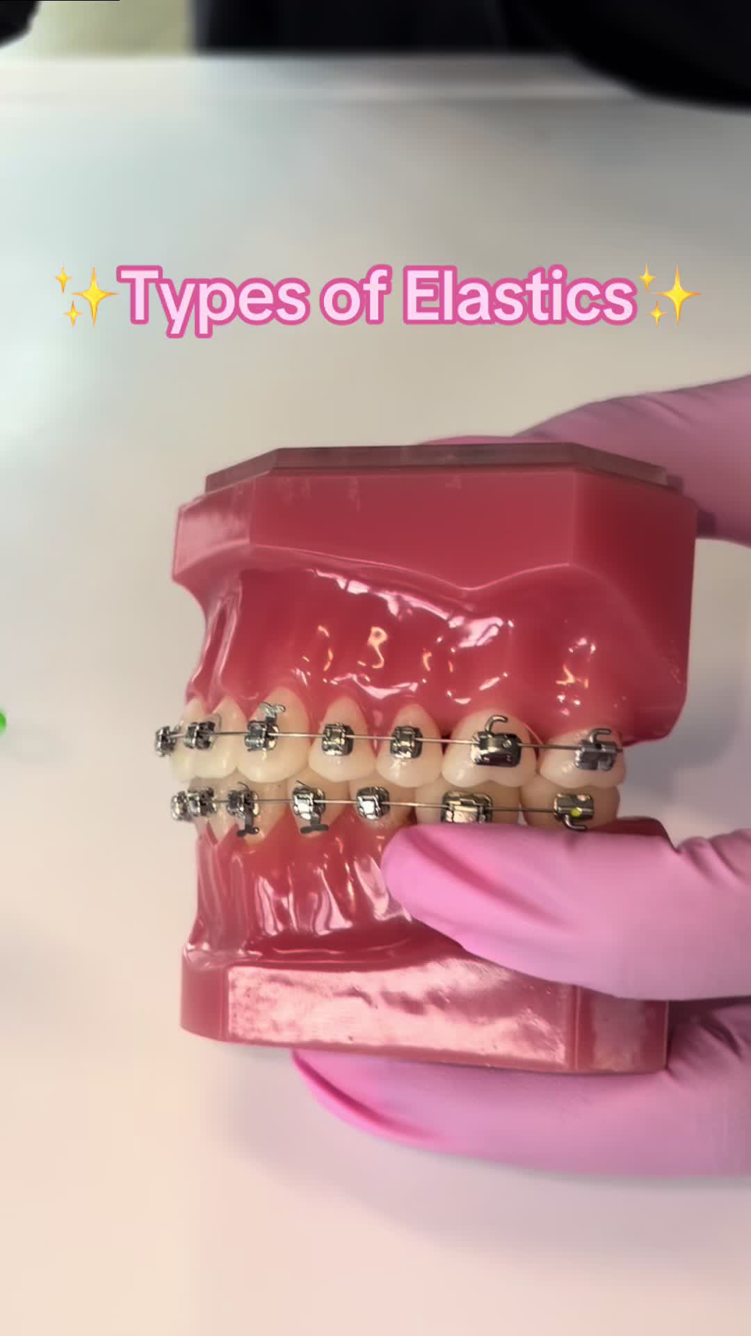 @Johnson Elite Orthodontics