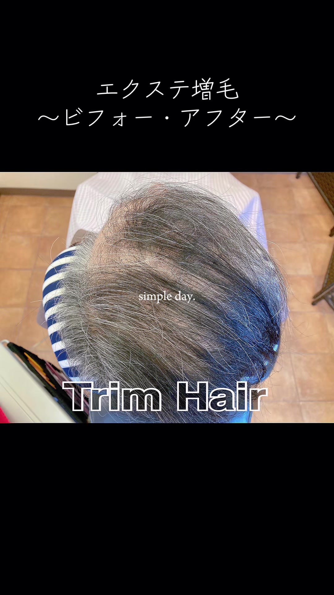 @Trim Hair