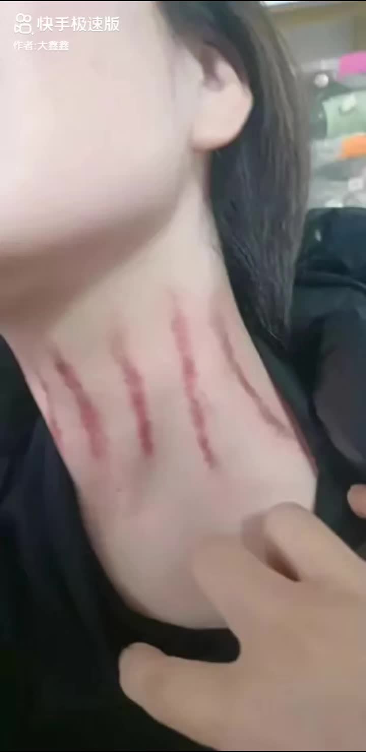 @thích cạo gió