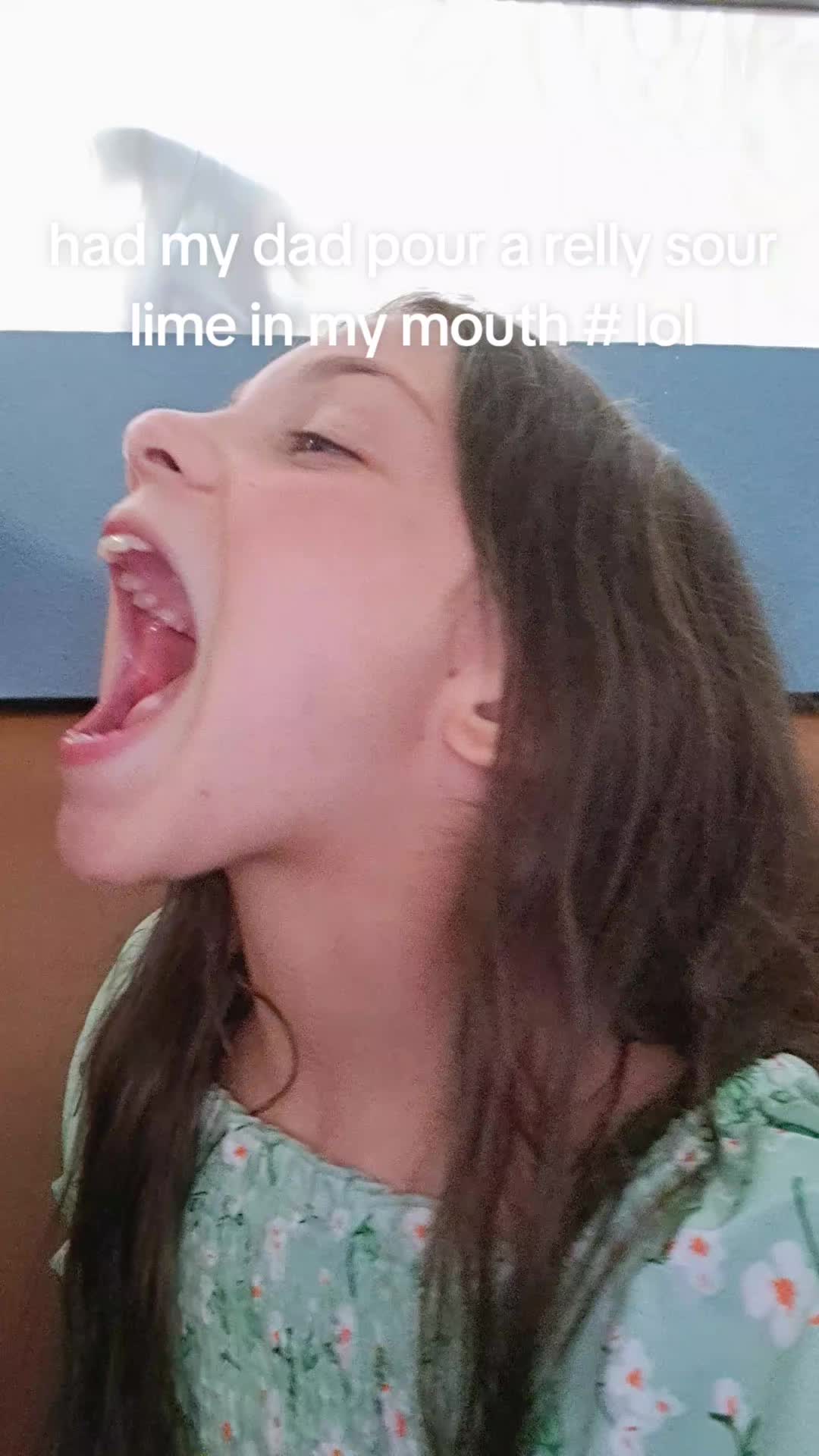 @RJ