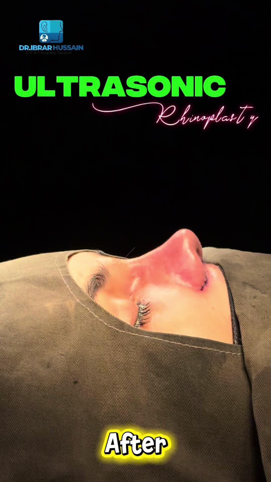 @Dr Ibrar ENT & Rhinoplasty