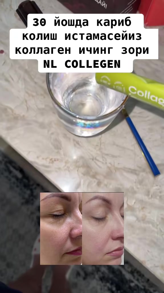 @COLLAGEN NL